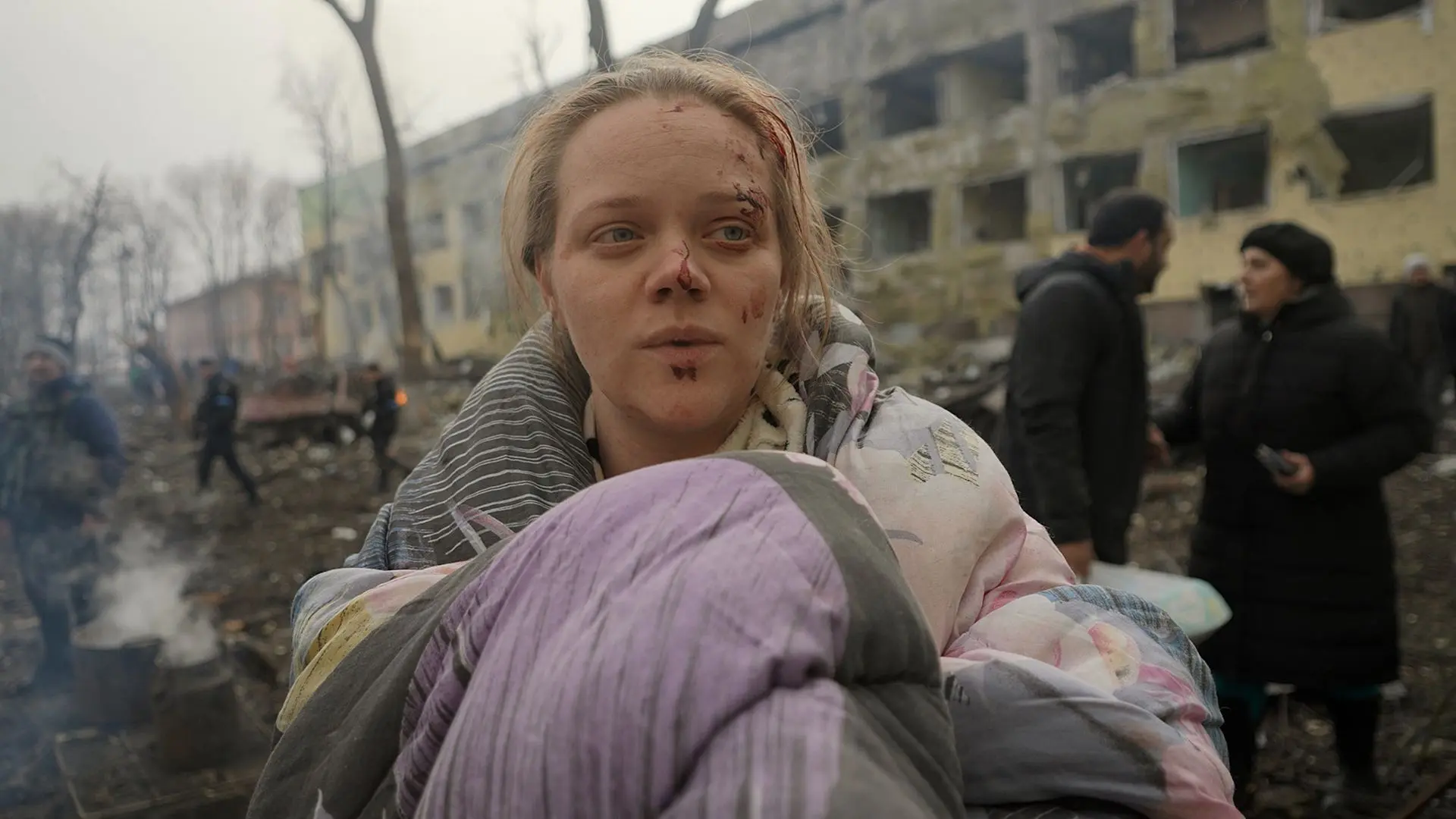 تصویری از زنی زخمی در جنگ روسیه و اوکراین در مستند 20 Days in Mariupol